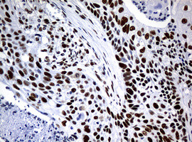 NBN Antibody in Immunohistochemistry (Paraffin) (IHC (P))