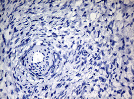 NBN Antibody in Immunohistochemistry (Paraffin) (IHC (P))