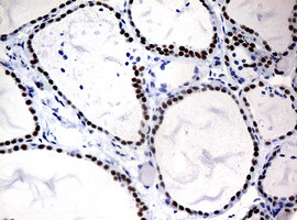 NBN Antibody in Immunohistochemistry (Paraffin) (IHC (P))