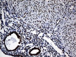 NBN Antibody in Immunohistochemistry (Paraffin) (IHC (P))