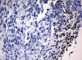 NBN Antibody in Immunohistochemistry (Paraffin) (IHC (P))