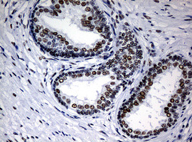 NBN Antibody in Immunohistochemistry (Paraffin) (IHC (P))