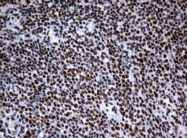 NBN Antibody in Immunohistochemistry (Paraffin) (IHC (P))