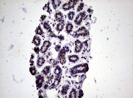 NBN Antibody in Immunohistochemistry (Paraffin) (IHC (P))