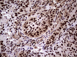 NBN Antibody in Immunohistochemistry (Paraffin) (IHC (P))