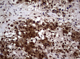 NBN Antibody in Immunohistochemistry (Paraffin) (IHC (P))