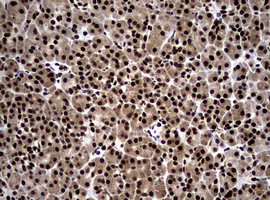 NBN Antibody in Immunohistochemistry (Paraffin) (IHC (P))