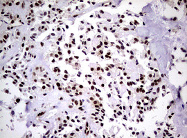 NBN Antibody in Immunohistochemistry (Paraffin) (IHC (P))