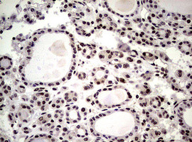 NBN Antibody in Immunohistochemistry (Paraffin) (IHC (P))