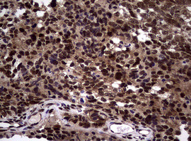 NBN Antibody in Immunohistochemistry (Paraffin) (IHC (P))