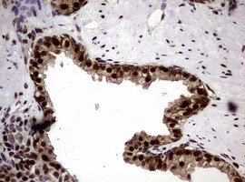 NBN Antibody in Immunohistochemistry (Paraffin) (IHC (P))