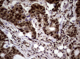 NBN Antibody in Immunohistochemistry (Paraffin) (IHC (P))