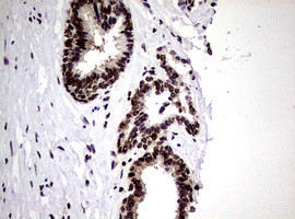 NBN Antibody in Immunohistochemistry (Paraffin) (IHC (P))