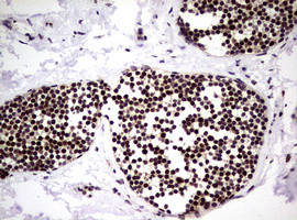 NBN Antibody in Immunohistochemistry (Paraffin) (IHC (P))