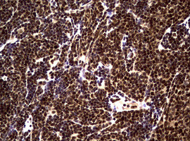 NBN Antibody in Immunohistochemistry (Paraffin) (IHC (P))