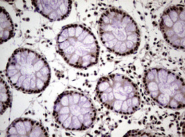 NBN Antibody in Immunohistochemistry (Paraffin) (IHC (P))