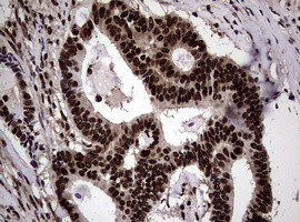 NBN Antibody in Immunohistochemistry (Paraffin) (IHC (P))