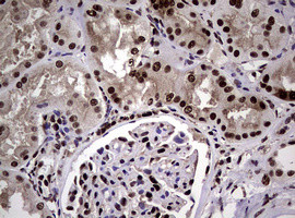 NBN Antibody in Immunohistochemistry (Paraffin) (IHC (P))