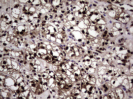 NBN Antibody in Immunohistochemistry (Paraffin) (IHC (P))