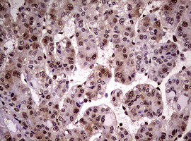 NBN Antibody in Immunohistochemistry (Paraffin) (IHC (P))