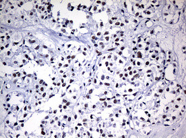 NBN Antibody in Immunohistochemistry (Paraffin) (IHC (P))