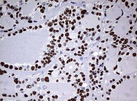 NBN Antibody in Immunohistochemistry (Paraffin) (IHC (P))