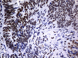 NBN Antibody in Immunohistochemistry (Paraffin) (IHC (P))