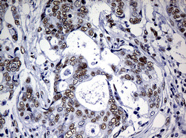 NBN Antibody in Immunohistochemistry (Paraffin) (IHC (P))