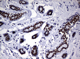 NBN Antibody in Immunohistochemistry (Paraffin) (IHC (P))