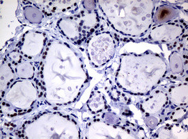 NBN Antibody in Immunohistochemistry (Paraffin) (IHC (P))