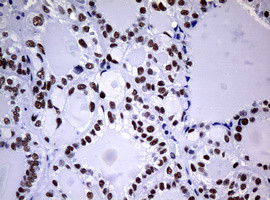 NBN Antibody in Immunohistochemistry (Paraffin) (IHC (P))