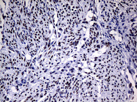 NBN Antibody in Immunohistochemistry (Paraffin) (IHC (P))