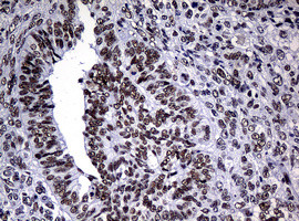 NBN Antibody in Immunohistochemistry (Paraffin) (IHC (P))