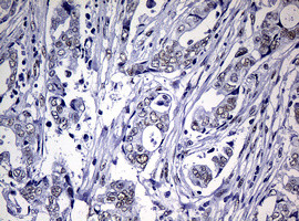 NBN Antibody in Immunohistochemistry (Paraffin) (IHC (P))