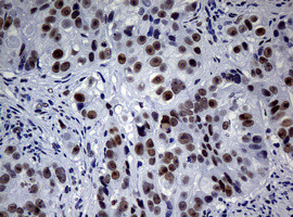 NBN Antibody in Immunohistochemistry (Paraffin) (IHC (P))