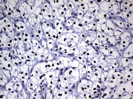 NBN Antibody in Immunohistochemistry (Paraffin) (IHC (P))