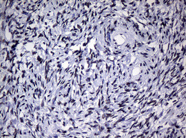 NBN Antibody in Immunohistochemistry (Paraffin) (IHC (P))