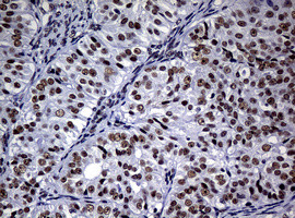 NBN Antibody in Immunohistochemistry (Paraffin) (IHC (P))