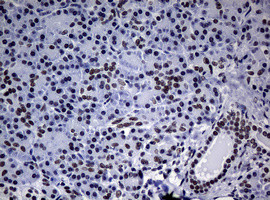 NBN Antibody in Immunohistochemistry (Paraffin) (IHC (P))