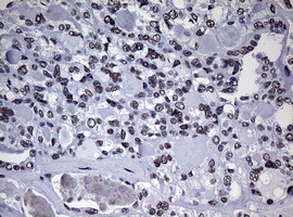 NBN Antibody in Immunohistochemistry (Paraffin) (IHC (P))