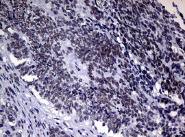 NBN Antibody in Immunohistochemistry (Paraffin) (IHC (P))