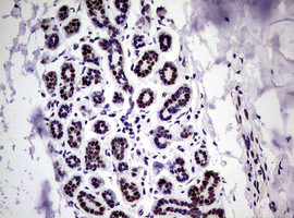 NBN Antibody in Immunohistochemistry (Paraffin) (IHC (P))