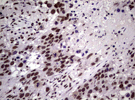 NBN Antibody in Immunohistochemistry (Paraffin) (IHC (P))