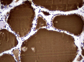 NBN Antibody in Immunohistochemistry (Paraffin) (IHC (P))