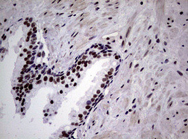 NBN Antibody in Immunohistochemistry (Paraffin) (IHC (P))