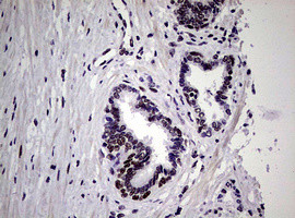 NBN Antibody in Immunohistochemistry (Paraffin) (IHC (P))