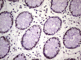 NBN Antibody in Immunohistochemistry (Paraffin) (IHC (P))