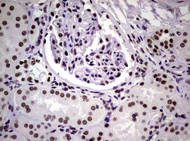 NBN Antibody in Immunohistochemistry (Paraffin) (IHC (P))