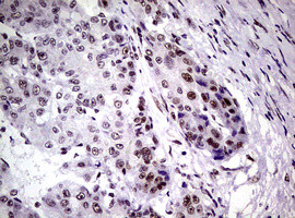 NBN Antibody in Immunohistochemistry (Paraffin) (IHC (P))