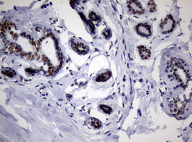 NBN Antibody in Immunohistochemistry (Paraffin) (IHC (P))